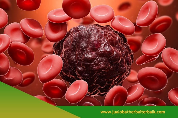 Obat Herbal Kanker di Jakarta