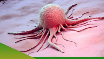 Jual Obat Herbal Kanker di Jakarta