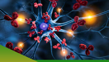 Obat Herbal Autoimun di Jakarta